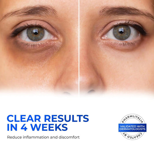 Crema de Ojos con Retinol para la Hinchazón y Bolsas Debajo de los Ojos con Ácido Hialurónico y Péptidos