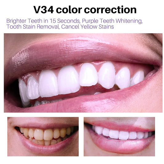 Espuma Blanqueadora de Dientes Lanthome V34 para el Cuidado Oral