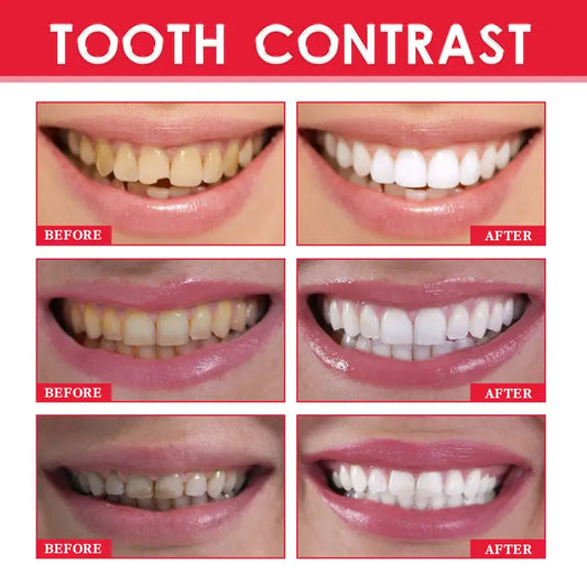 Esencia Blanqueadora de Dientes para Manchas y Aliento Fresco