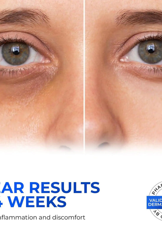 Crema de Ojos con Retinol para la Hinchazón y Bolsas Debajo de los Ojos con Ácido Hialurónico y Péptidos