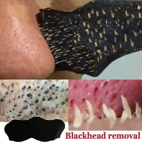 Mascarilla nasal para eliminar puntos negros - 5/10/15/20 Pieces