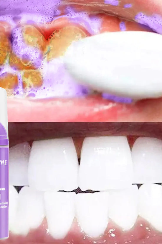 Espuma Blanqueadora de Dientes Lanthome V34 para el Cuidado Oral