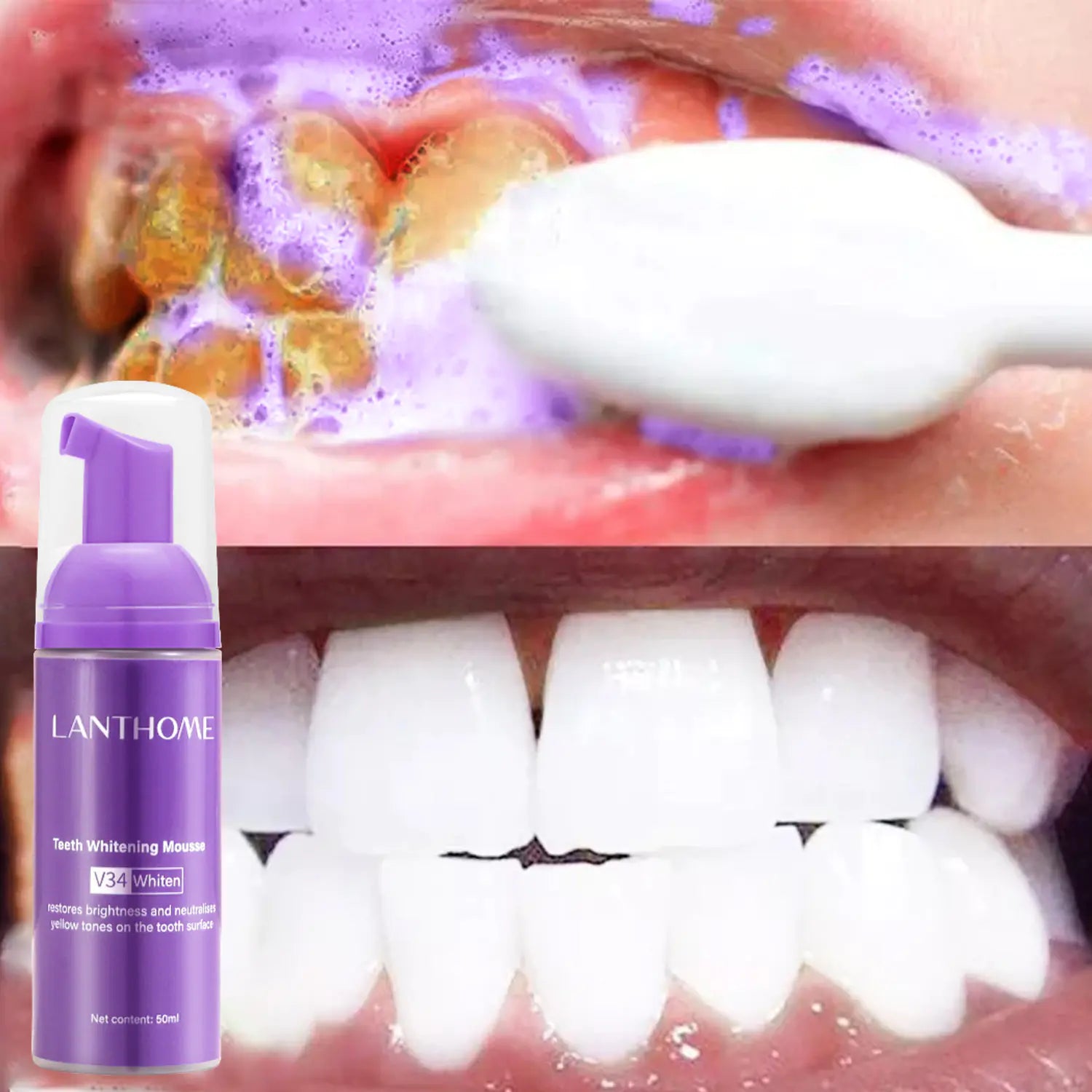 Espuma Blanqueadora de Dientes Lanthome V34 para el Cuidado Oral