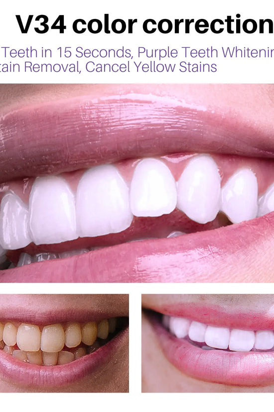 Espuma Blanqueadora de Dientes Lanthome V34 para el Cuidado Oral