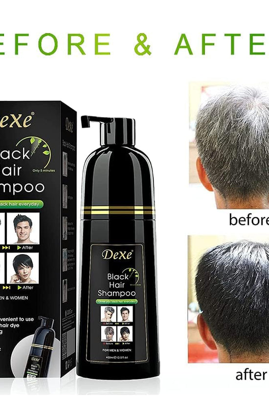 UniForU Champú Tinte de Cabello Negro 400ml Color Instantáneo por hasta 30 Días para Mujeres y Hombres