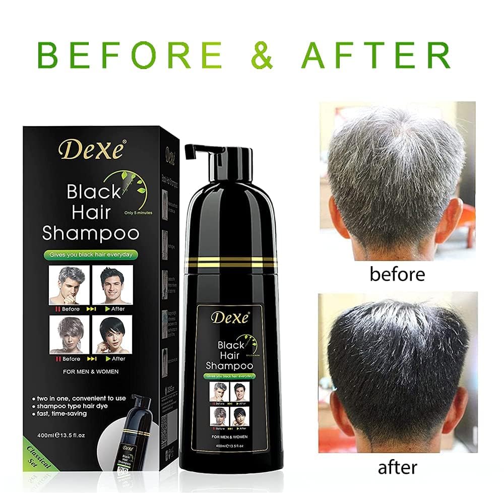 UniForU Champú Tinte de Cabello Negro 400ml Color Instantáneo por hasta 30 Días para Mujeres y Hombres
