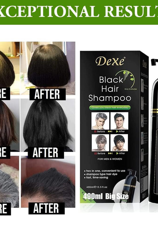 UniForU Champú Tinte de Cabello Negro 400ml Color Instantáneo por hasta 30 Días para Mujeres y Hombres