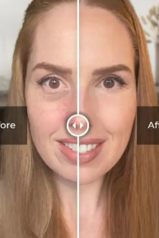 Suero hidratante para el cuidado de los ojos: rejuvenezca sus ojos