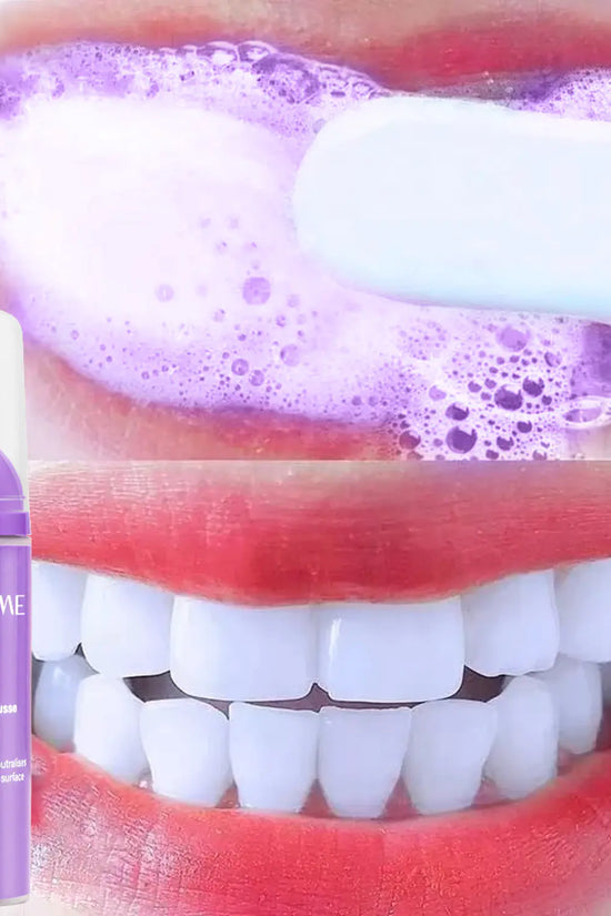 Espuma Blanqueadora de Dientes Lanthome V34 para el Cuidado Oral