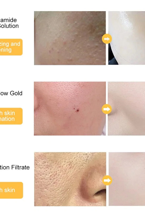 Suero Facial de Ácido Hialurónico con Oro de 24k: Experimenta la Belleza Dorada